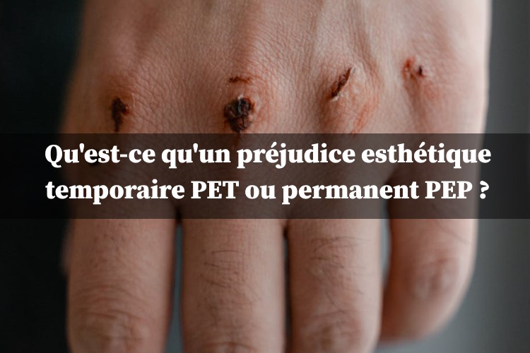 préjudice esthétique